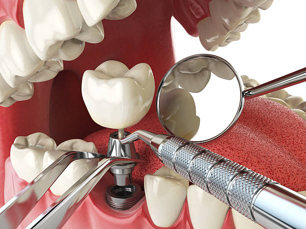 Best Weekend Emergency Dentist in East Bethel, MN